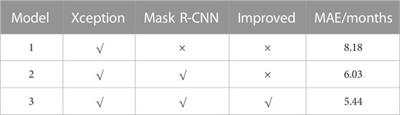 Bone age recognition based on mask R-CNN using xception regression model